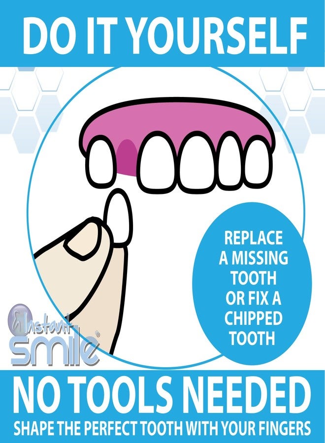 Instant Smile Themal Fitting Temporary Tooth Replacement Fitting Beads - Image 4